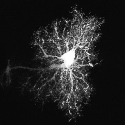 astrocyte