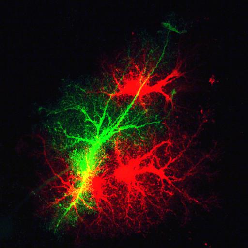 astrocyte