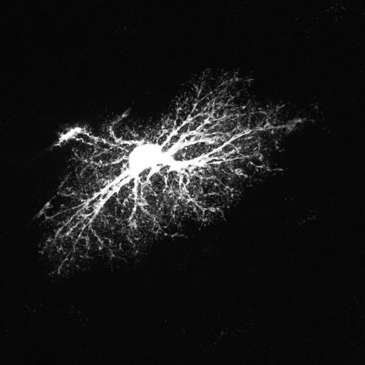 astrocyte