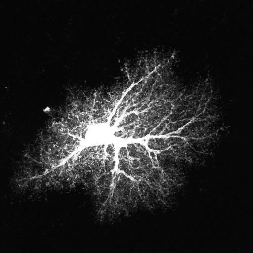 astrocyte