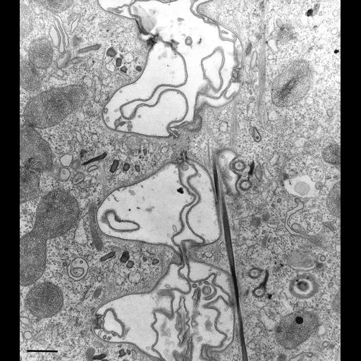 eukaryotic cell