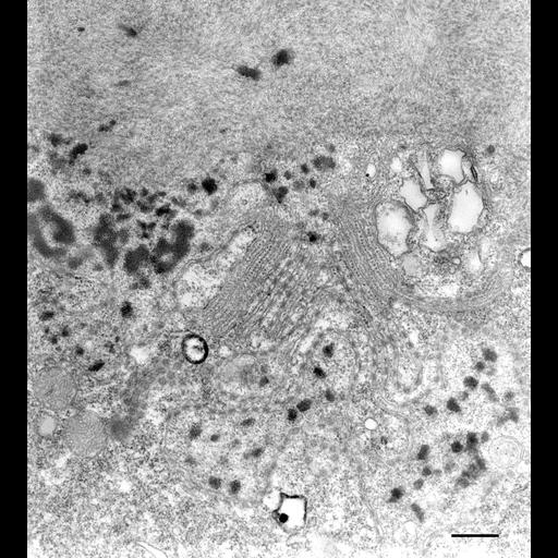 eukaryotic cell