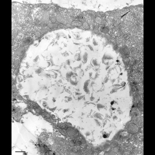 eukaryotic cell