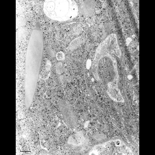 eukaryotic cell