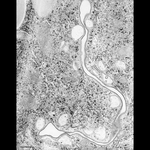 eukaryotic cell