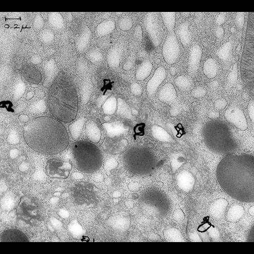 exocrine cell