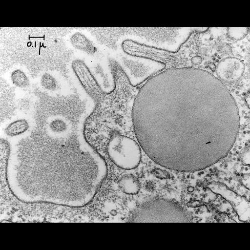 pancreatic acinar cell