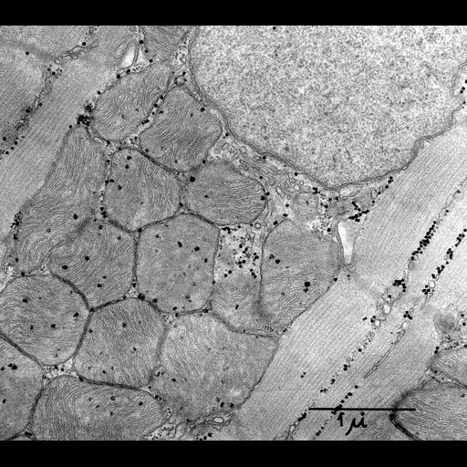 cardiac muscle cell