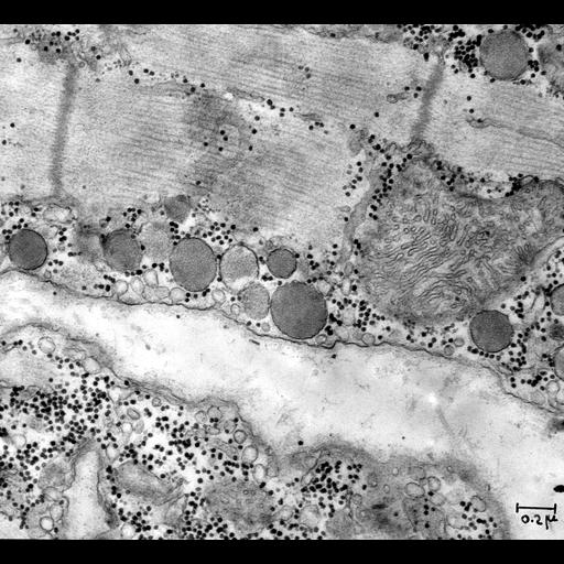 cardiac muscle cell