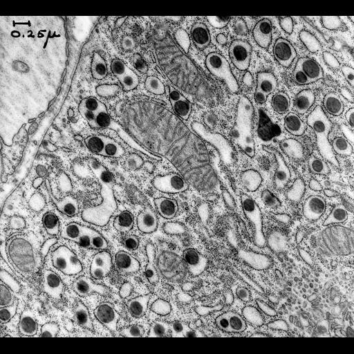 pancreatic cell