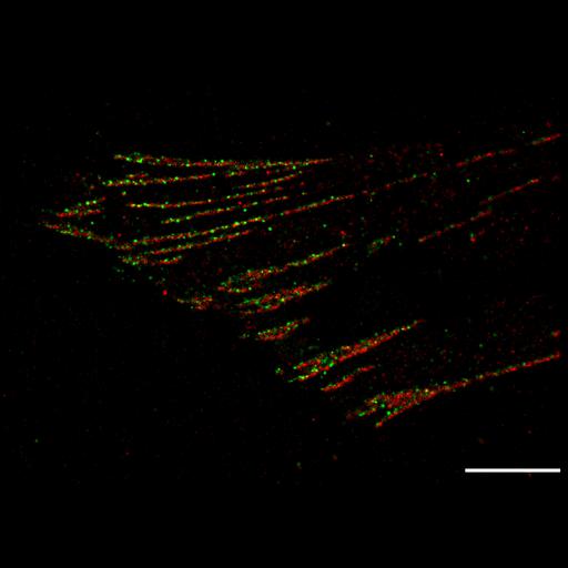 fibroblast