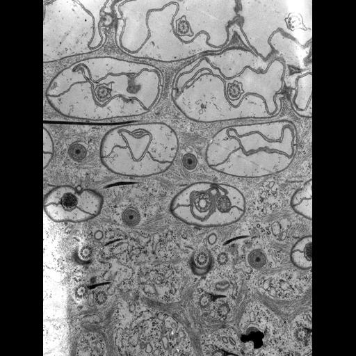 eukaryotic cell