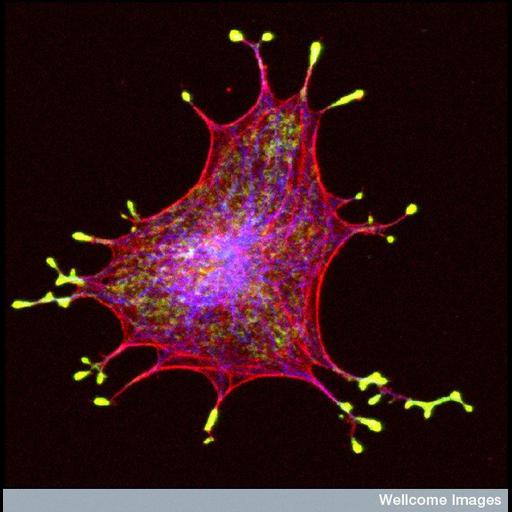 melanocyte