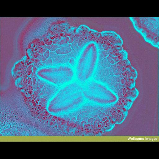 Gram-negative bacteria