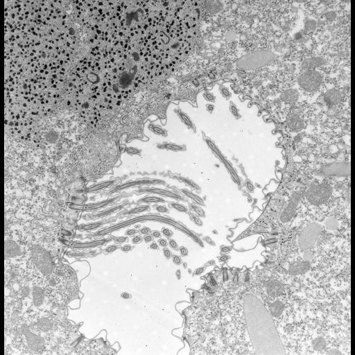 eukaryotic cell