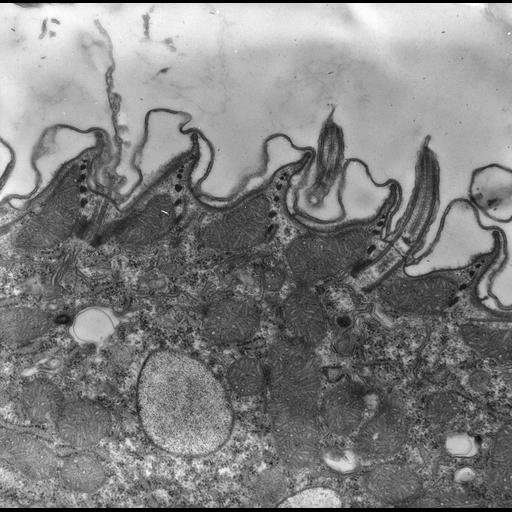 eukaryotic cell