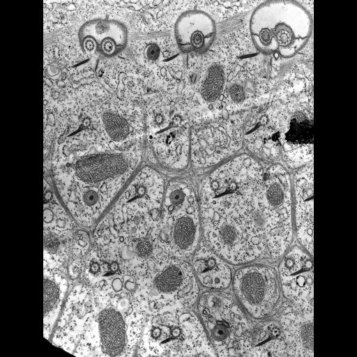 eukaryotic cell