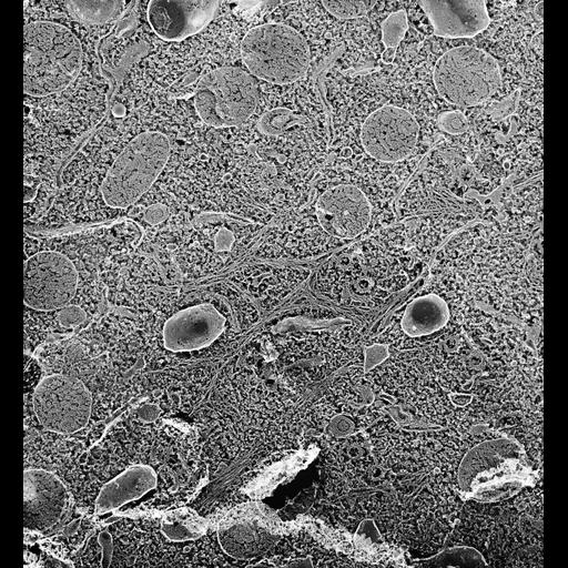 eukaryotic cell