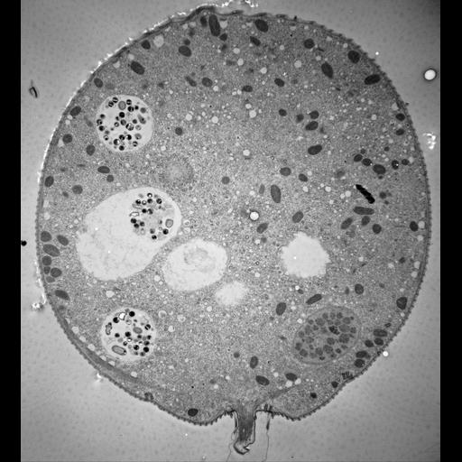 eukaryotic cell