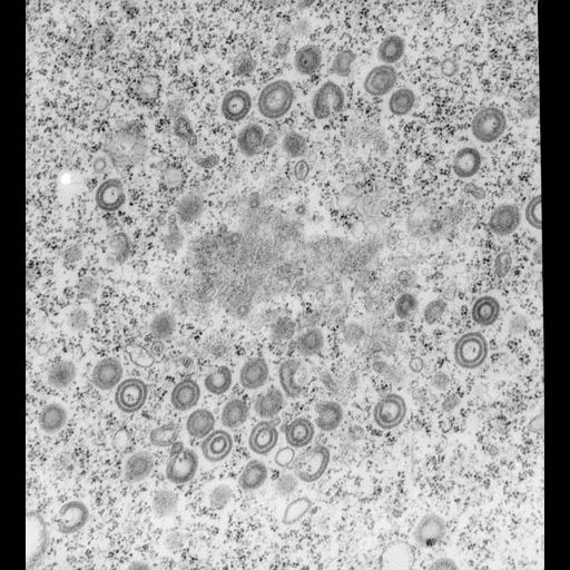 eukaryotic cell