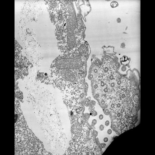 eukaryotic cell