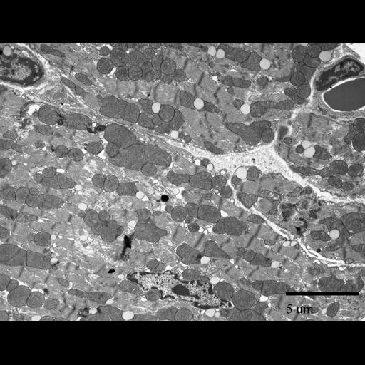 cardiac muscle cell