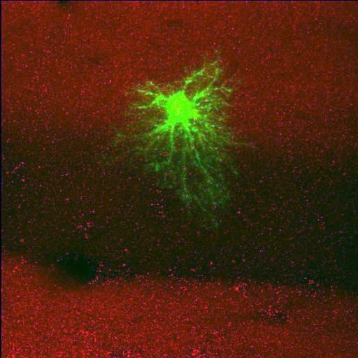 astrocyte