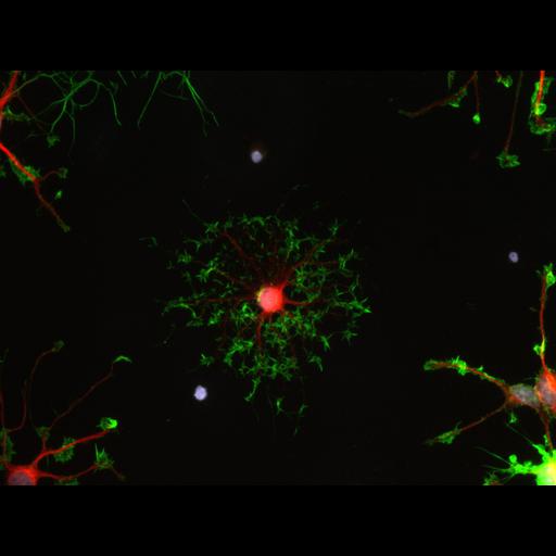 oligodendrocyte