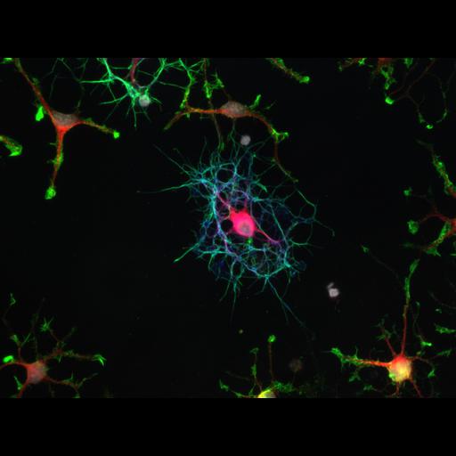 oligodendrocyte