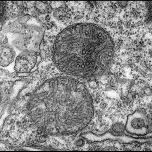 eukaryotic cell