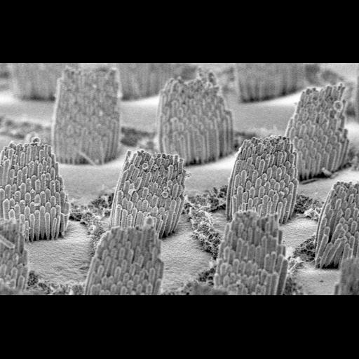 cochlear inner hair cell