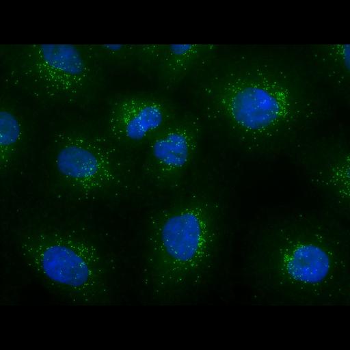 epithelial cell