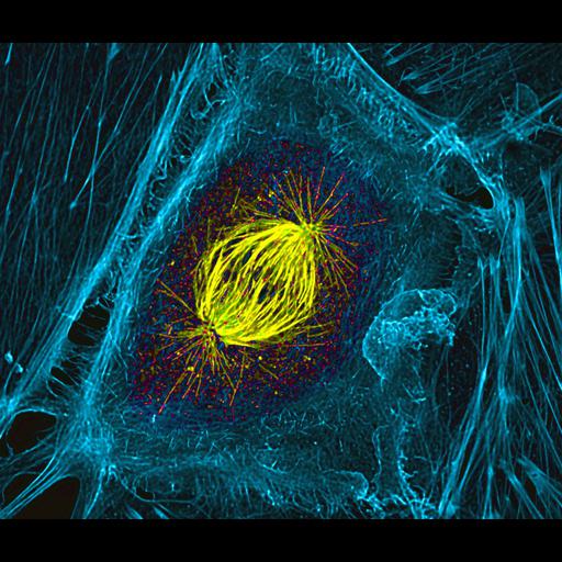 epithelial cell