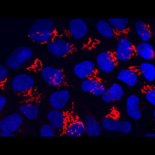 embryonic stem cell