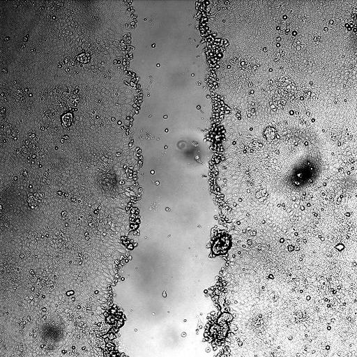 kidney epithelial cell