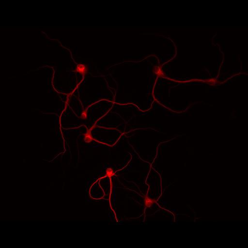 multipolar neuron