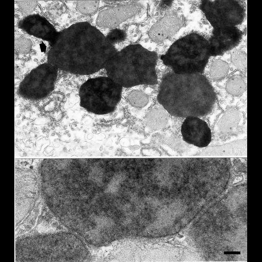 parenchymal cell