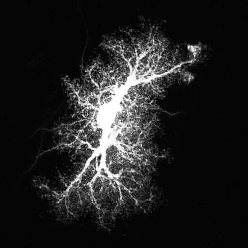 astrocyte