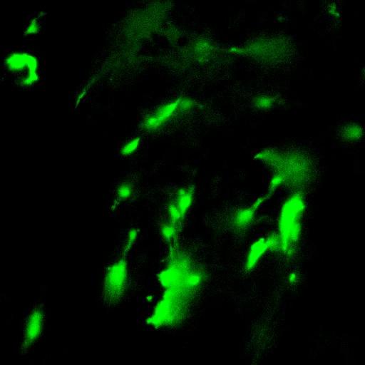 MC38-Cerulean cancer cells