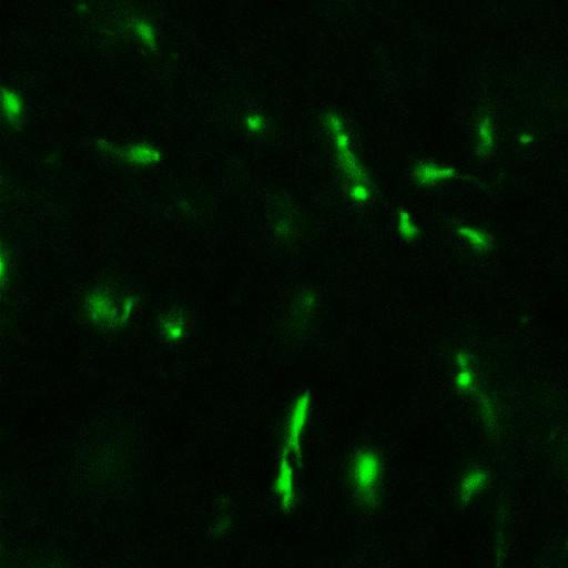MC38-Cerulean cancer cells