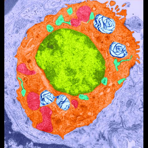 alveolar type II cell