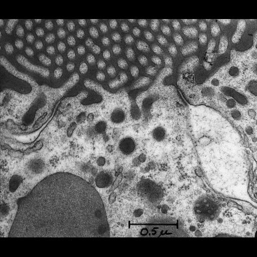 epithelial cell