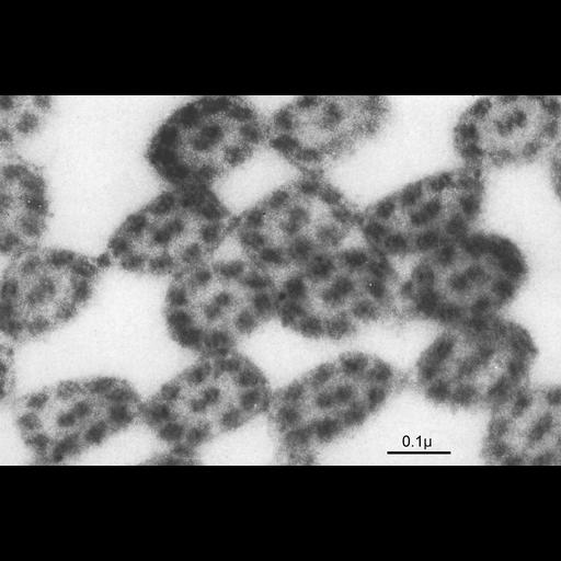 epithelial cell