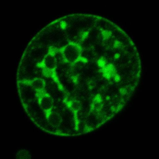 nuclear chromatin