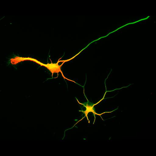 multipolar neuron