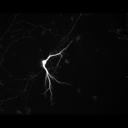 multipolar neuron