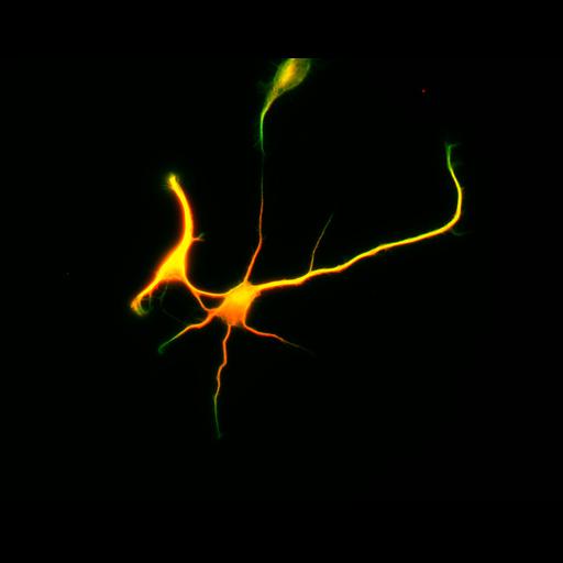 multipolar neuron