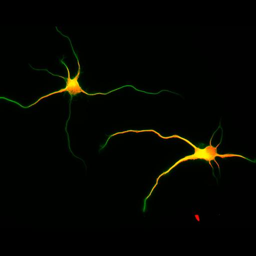 multipolar neuron