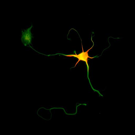 multipolar neuron