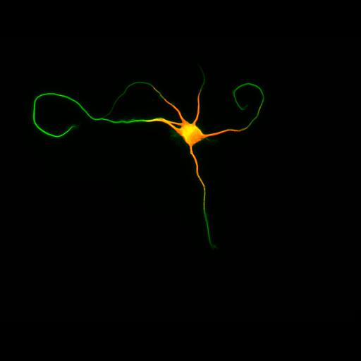 multipolar neuron